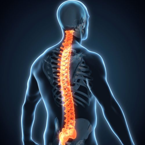 Spine-Problems-1